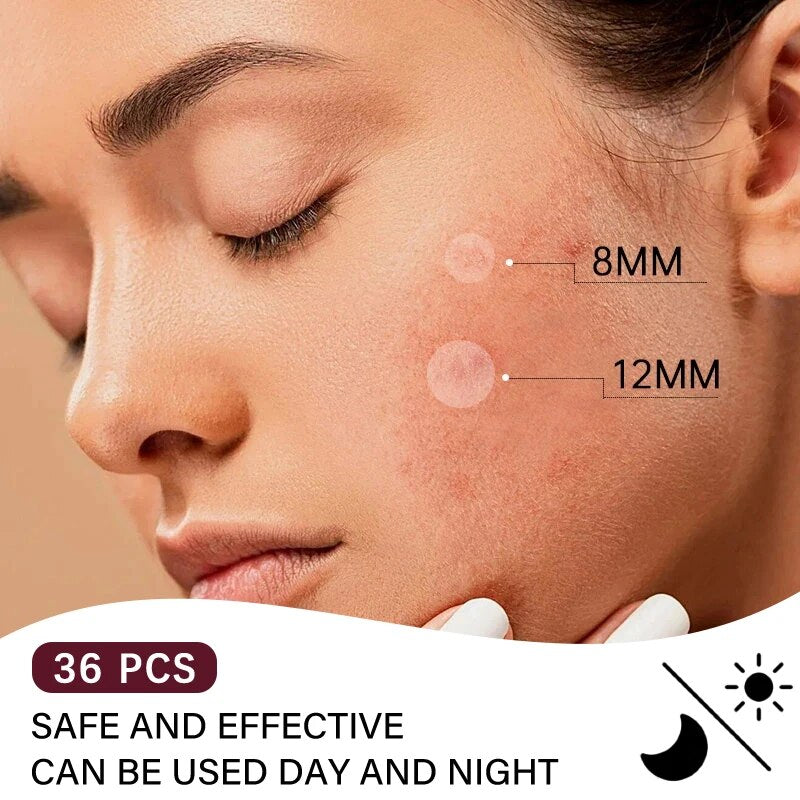 Acne Pac™ Odstraňovač pupínků