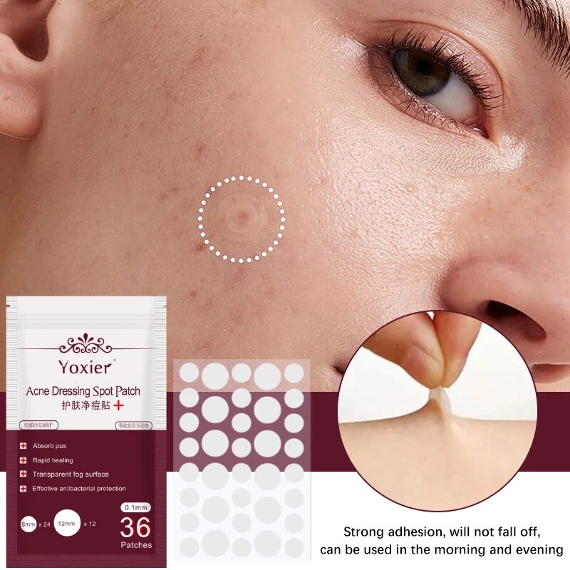 Acne Pac™ Odstraňovač pupínků