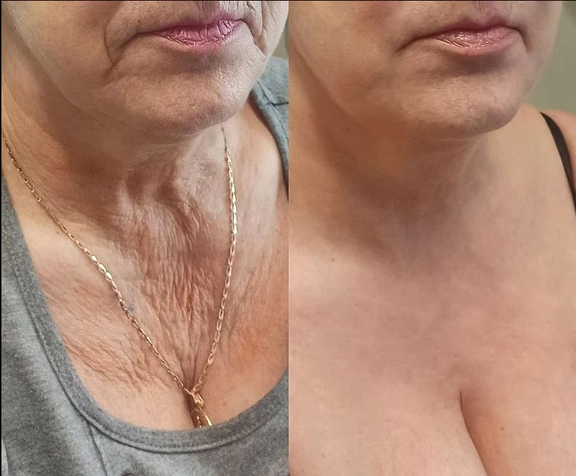 BOTOXIN™ Luxusní liftingový roll-on s včelím jedem a peptidy