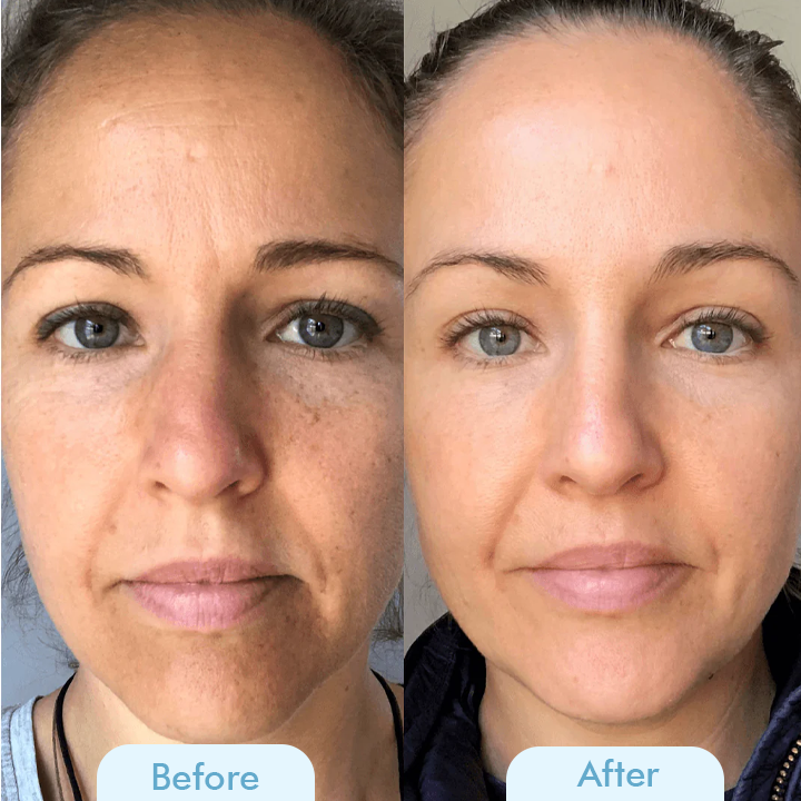 Bio Collagen™ Hloubková maska pro hladkou pleť