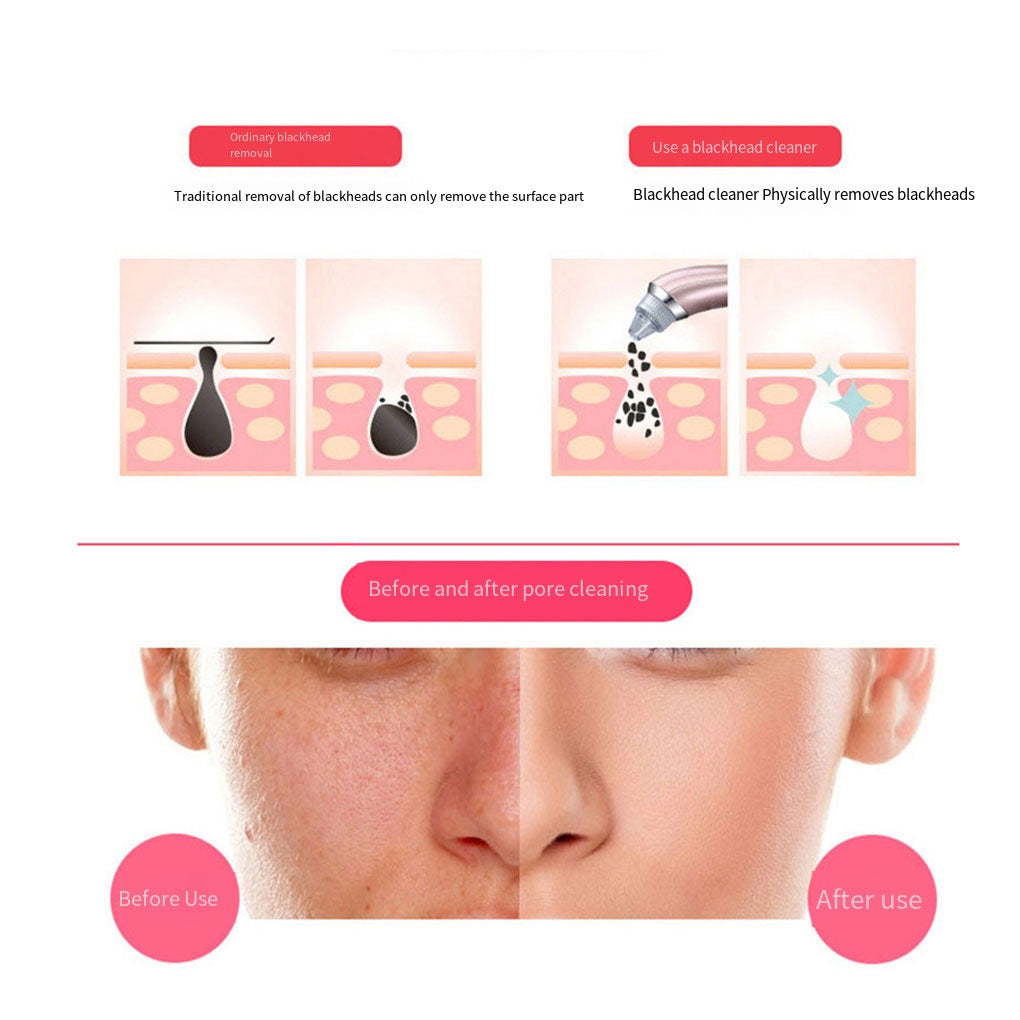 BioDerma+™ Přístroj 2 v 1 na čištění pórů a mikrodermabrazi