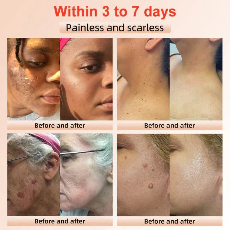 Brightique™ Rozjasňující exfoliační gel