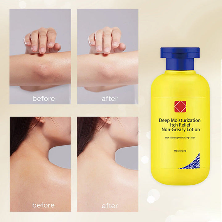 DermaLux™ Hloubkově hydratační krém proti svědění