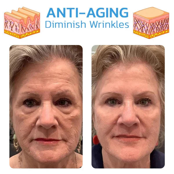 EELHOE Aging™ 30 Denní Kúra Proti Stárnutí