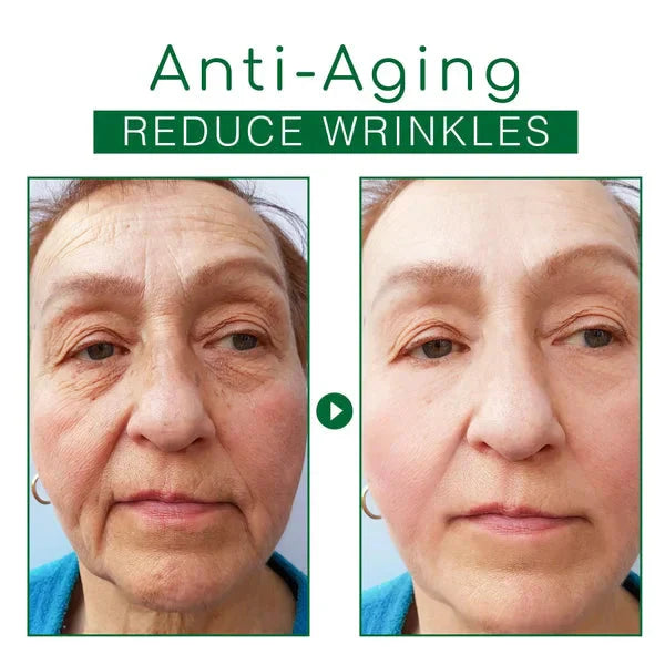 EELHOE Aging™ 30 Denní Kúra Proti Stárnutí