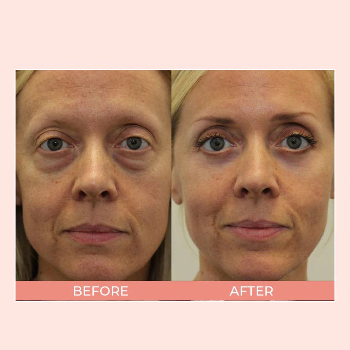 EELHOE EyeCream™ Retinolový oční krém v tyčince