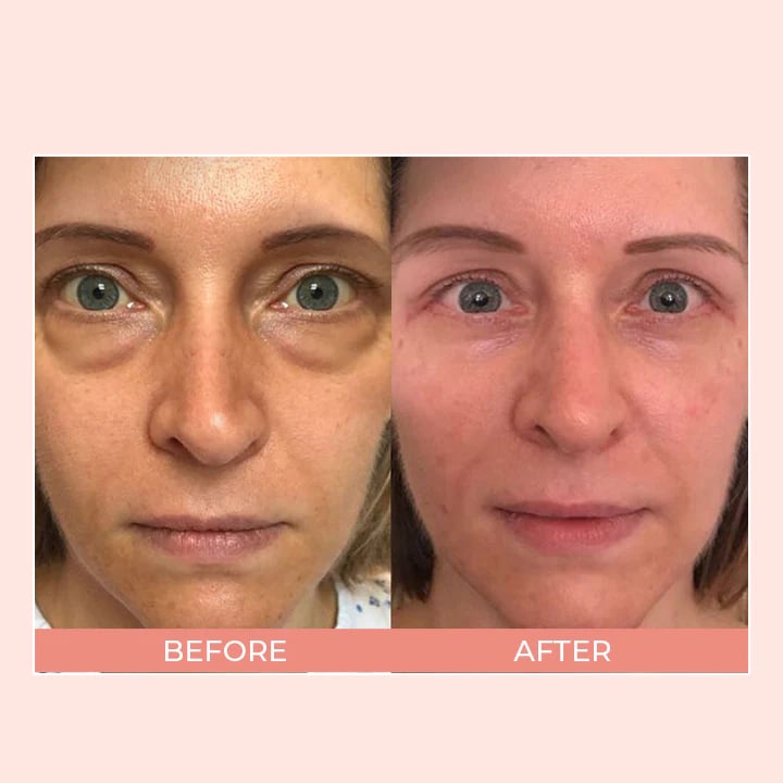 EELHOE EyeCream™ Retinolový oční krém v tyčince