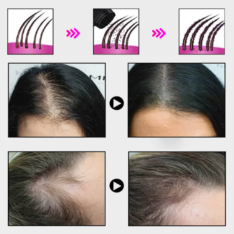 EELHOE HAIR™ Prášek proti vypadávání a rychlé vyplnění vlasové linie