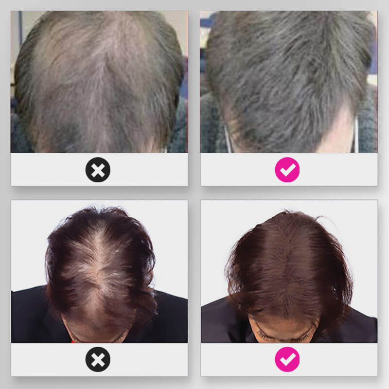 EELHOE HAIR™ Prášek proti vypadávání a rychlé vyplnění vlasové linie