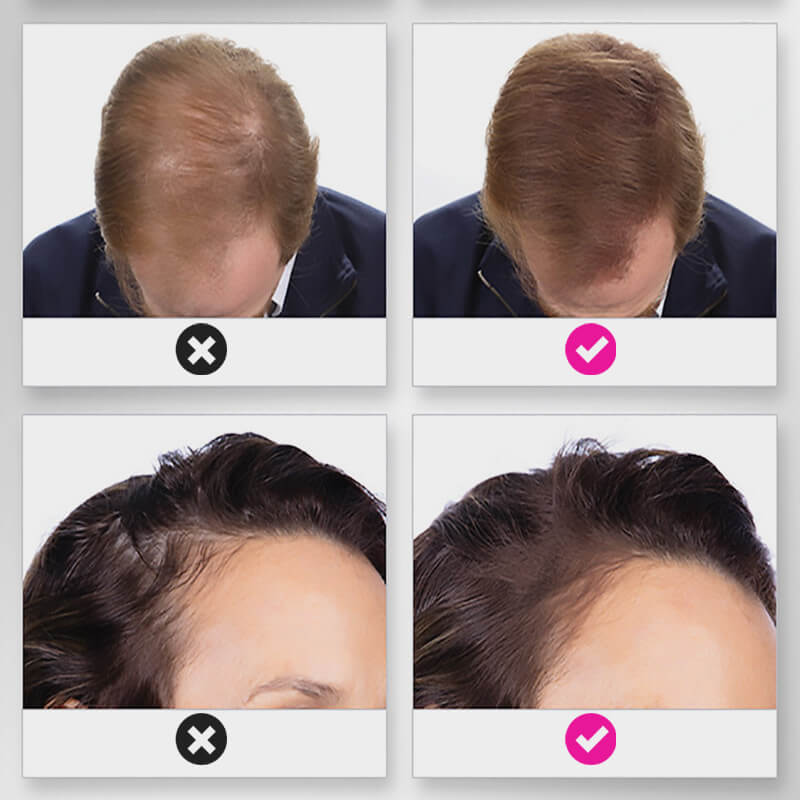 EELHOE HAIR™ Prášek proti vypadávání a rychlé vyplnění vlasové linie