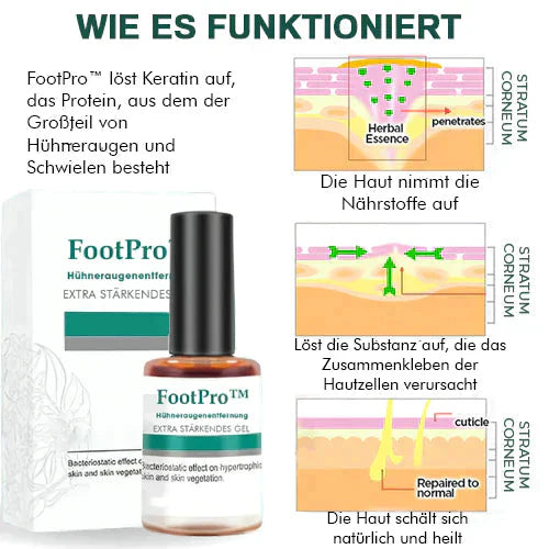 FootPro™️ Gel na odstraňování kukuřice