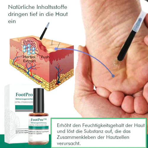 FootPro™️ Gel na odstraňování kukuřice