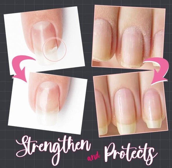 Full Beauty Nail Protect™ Gel na opravu nehtů