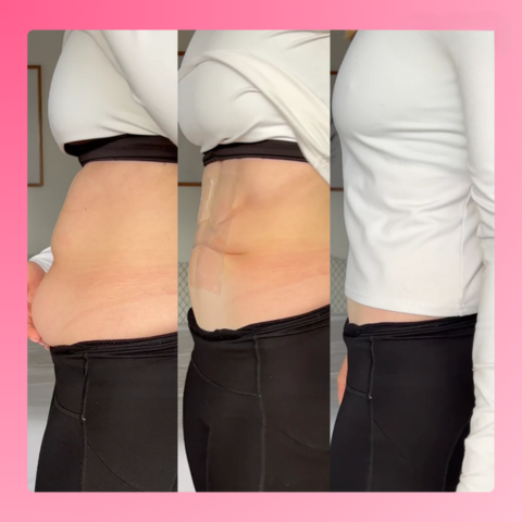 Invisilift™ Neviditelné zpevňující náplasti