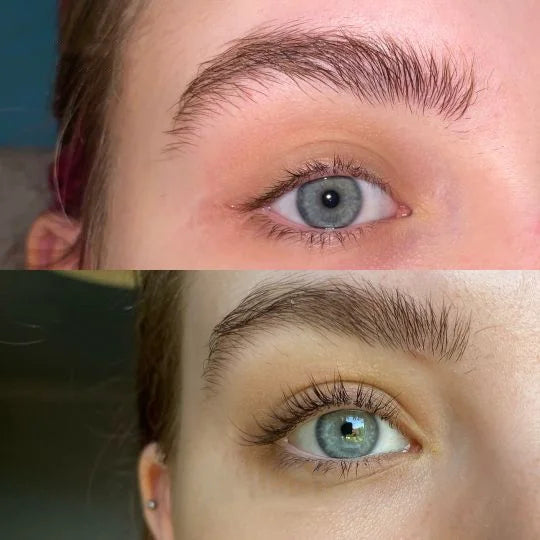 LashBloom™ Sérum pro růst řas