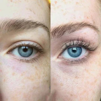 LashBloom™ Sérum pro růst řas