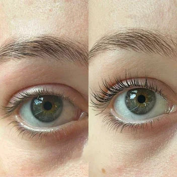 LashBloom™ Sérum pro růst řas
