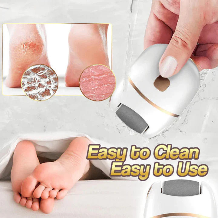 LumiFeet™ Šetrné odstraňování mozolů pro jemná a hladká chodidla
