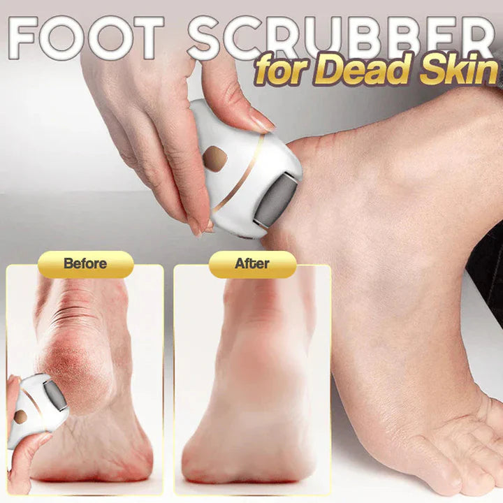 LumiFeet™ Šetrné odstraňování mozolů pro jemná a hladká chodidla