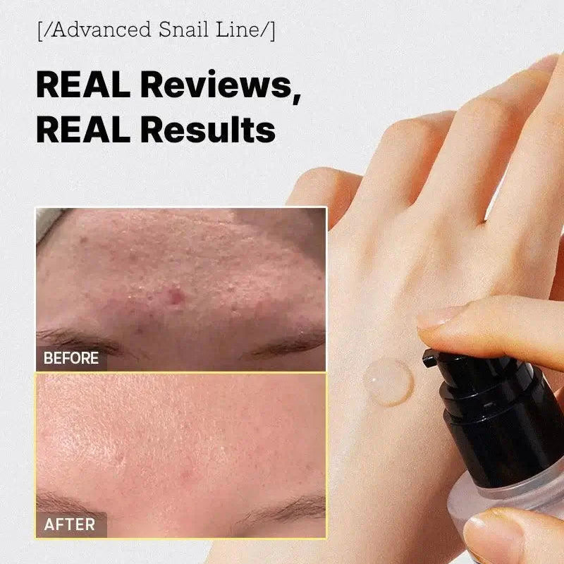 Mucisera™ Sérum se šnečím mucinem