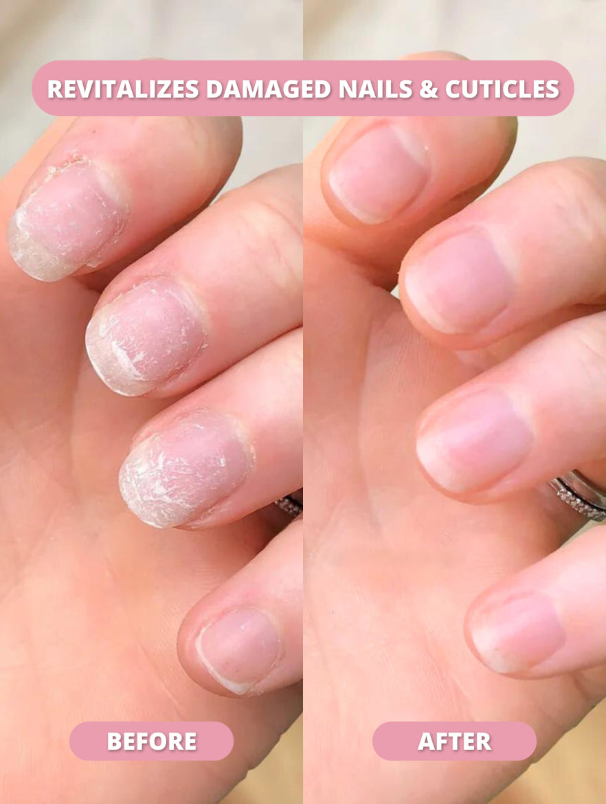 NailForté™ Posilovač nehtů