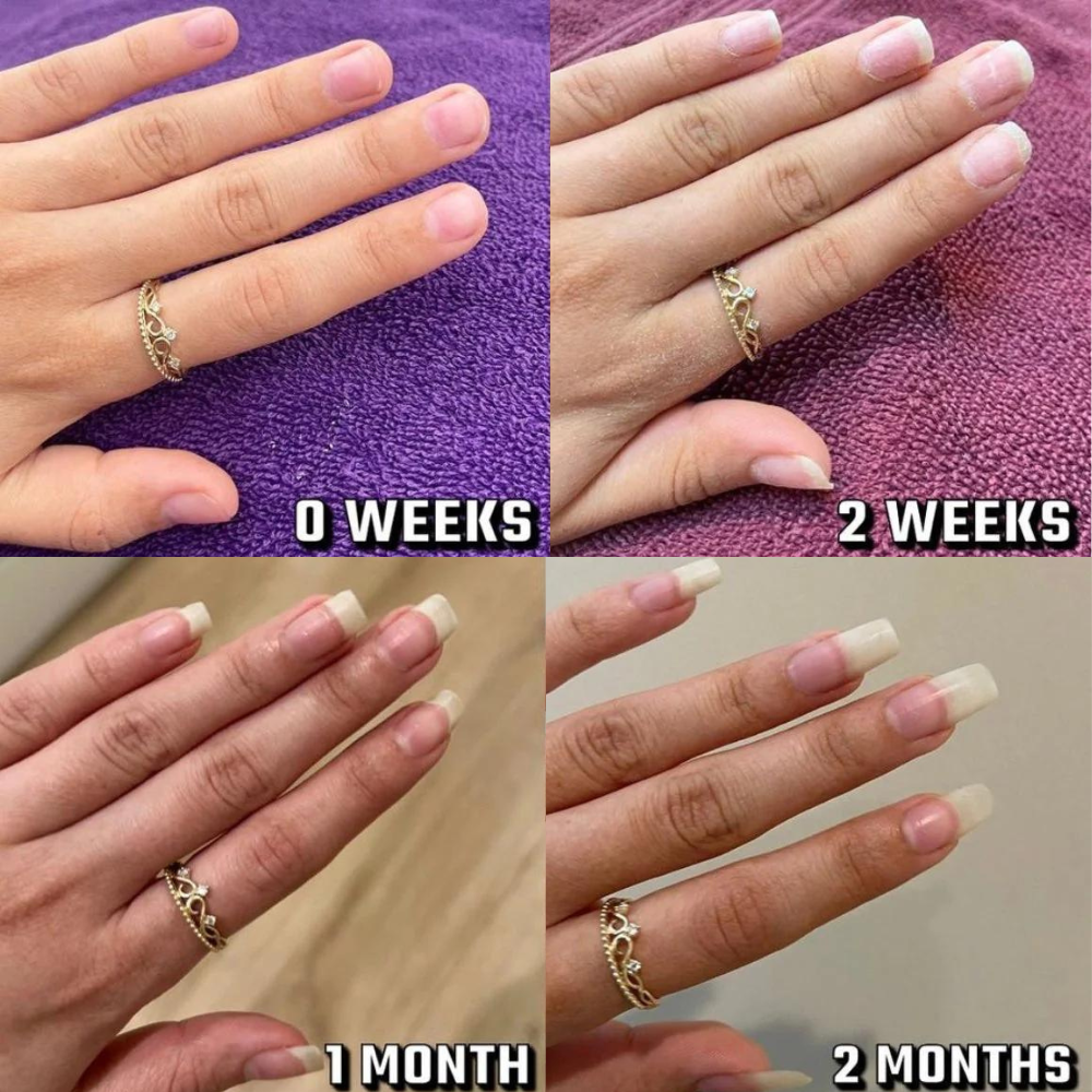 NailForté™ Posilovač nehtů