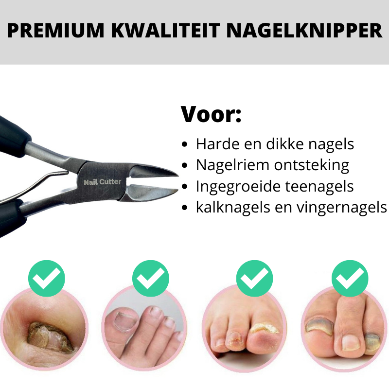 NailcutterPro™ Nejvýkonnější vyživující kleštičky na nehty!