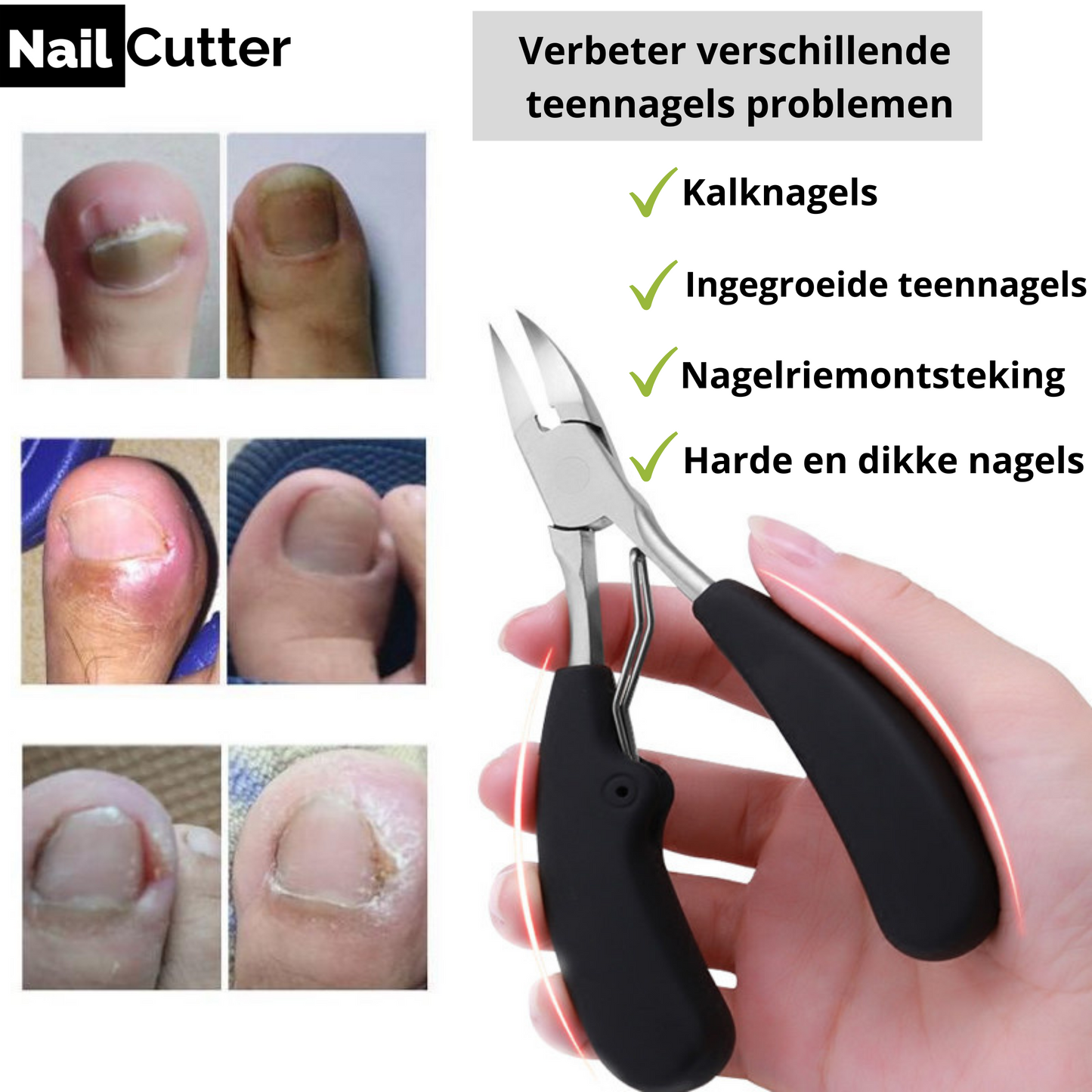 NailcutterPro™ Nejvýkonnější vyživující kleštičky na nehty!