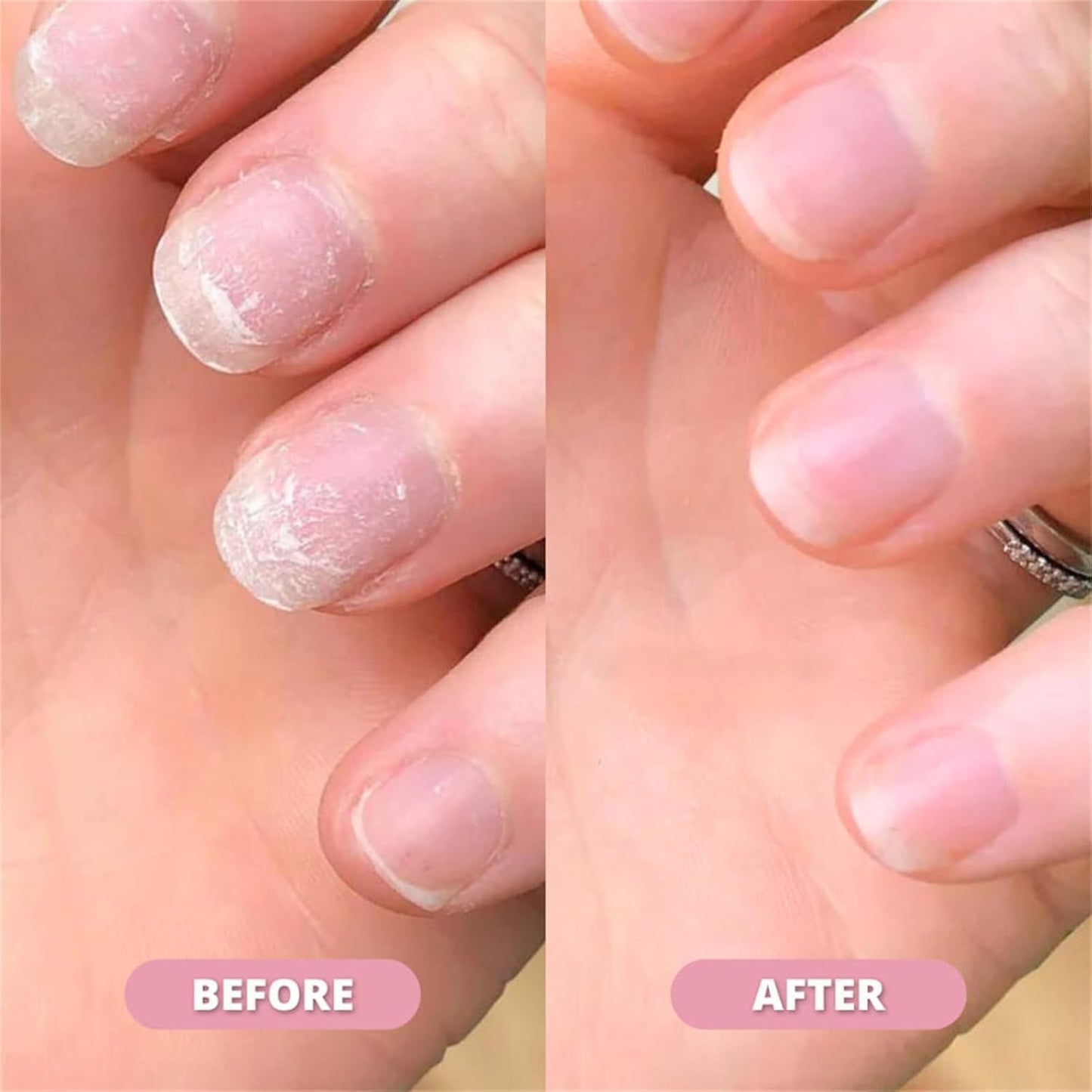 Nailora™ Posilující olejíček na nehty
