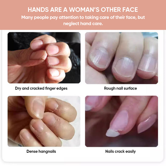 Nailora™ Posilující olejíček na nehty