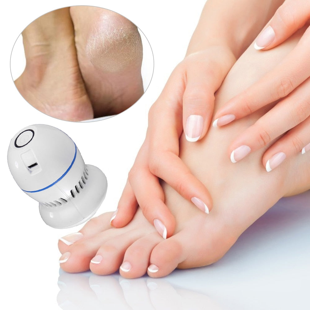 PediCare™️ Odstraňovač mozolů | Pro hedvábně hladká chodidla a už nikdy více mozoly!