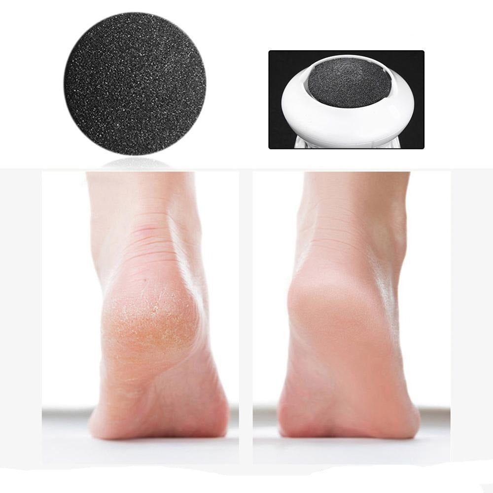PediCare™️ Odstraňovač mozolů | Pro hedvábně hladká chodidla a už nikdy více mozoly!
