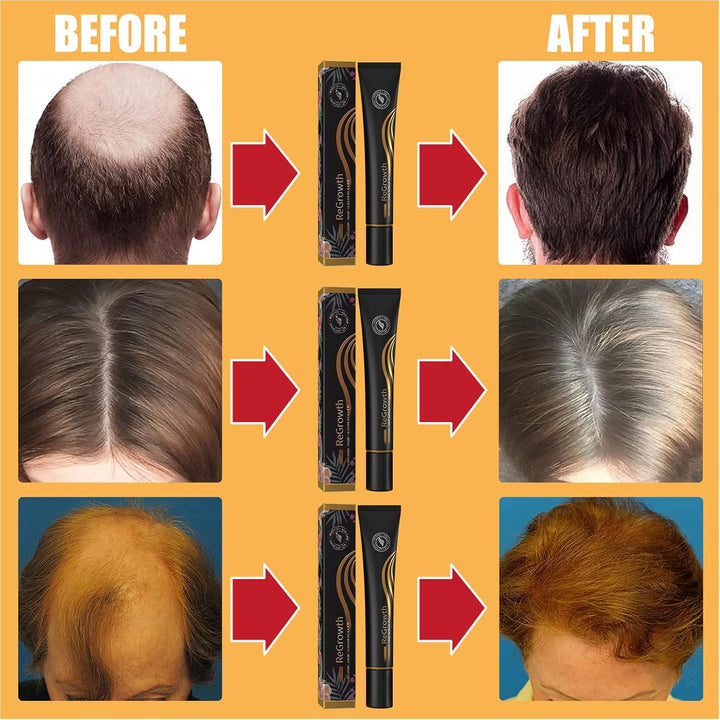 ReGrowth™ Bio péče o vlasy