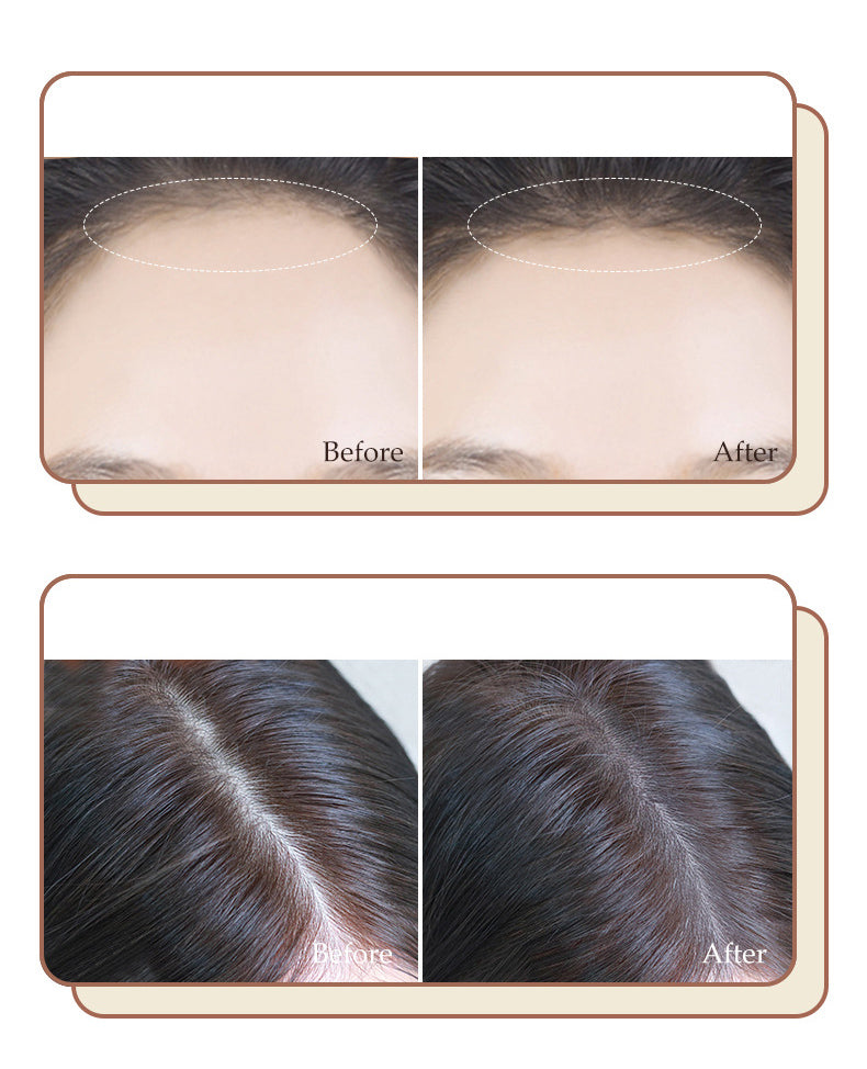ShadowPowder™ Hairline Filling Powder | Vodotěsné a okamžité krytí