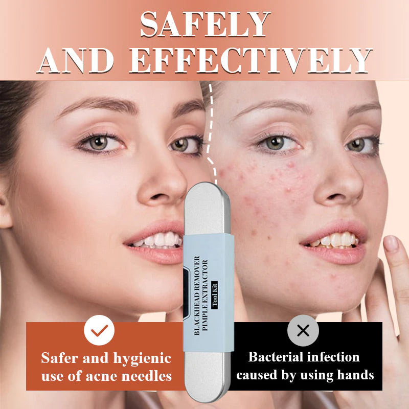 SkinAura™ Přesné odstranění černých teček