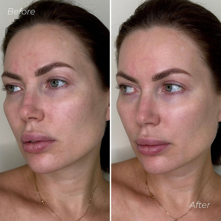VegiHydra™ Ultrahydratační rostlinné sérum