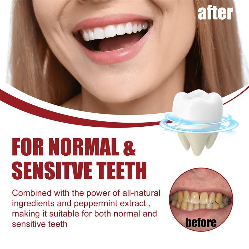 Vital Smile™ Zubní pasta Super Probiotic-6 se 6 probiotiky