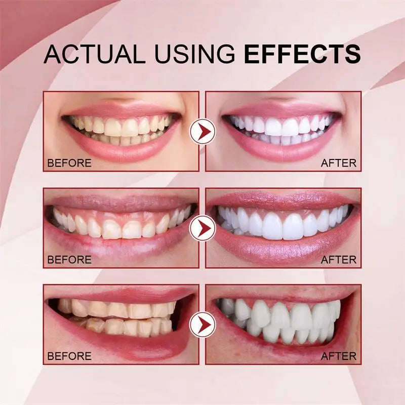 Vital Smile™ Zubní pasta Super Probiotic-6 se 6 probiotiky