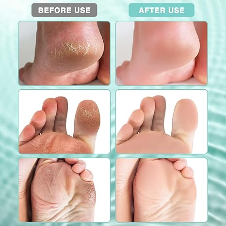 ArniCare™ Rychlá obnova na popraskané nohy