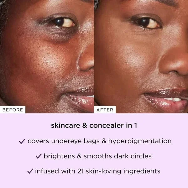 ContourPro™ Konturovací tyčinka