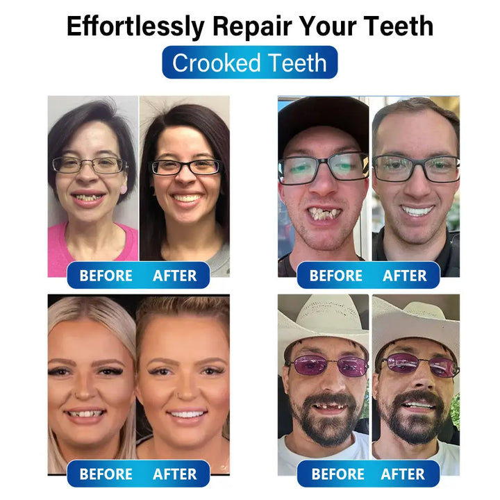 DentBlue™ Lampa s modrým světlem pro vytvrzování a materiál pro opravu zubů