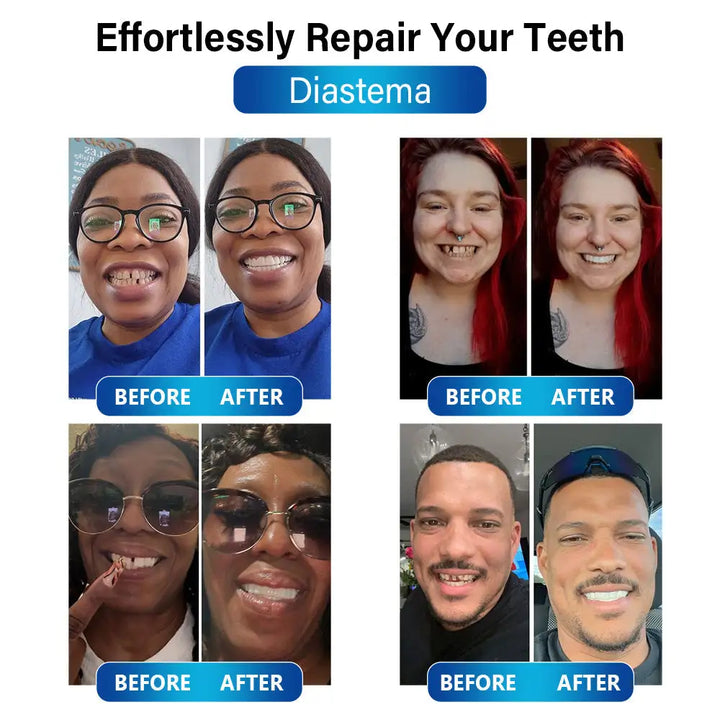 DentBlue™ Lampa s modrým světlem pro vytvrzování a materiál pro opravu zubů