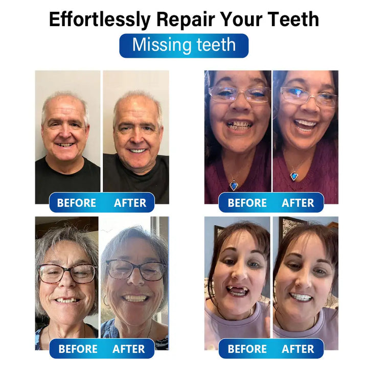 DentBlue™ Lampa s modrým světlem pro vytvrzování a materiál pro opravu zubů