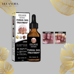 EELHOE Fungus™ Sérum na léčbu plísňě nehtů