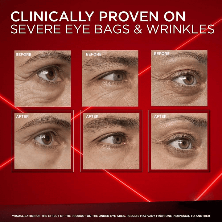 FrescaEye™ Okamžitý anti-aging krém na oči