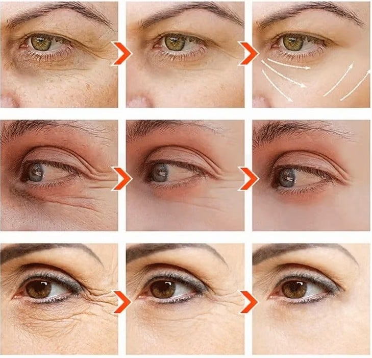 FrescaEye™ Okamžitý anti-aging krém na oči