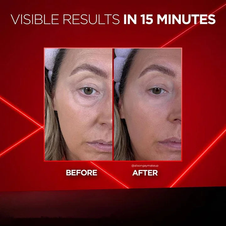 FrescaEye™ Okamžitý anti-aging krém na oči