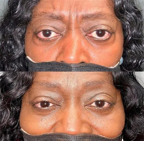 FrescaEye™ Okamžitý anti-aging krém na oči