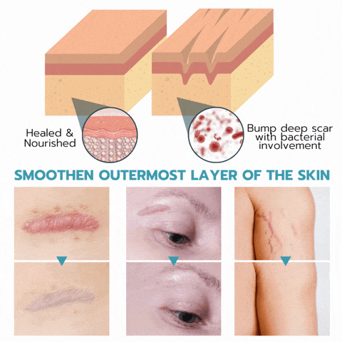 RejuvePatch™ Opakovně použitelné náplasti proti nedokonalostem na obličeji