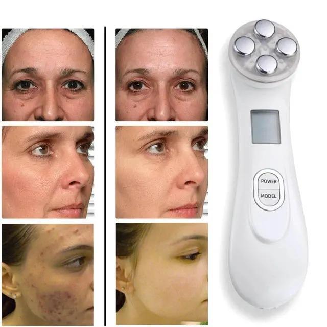 Revita Glow™ Masážní přístroj pro lifting pokožky